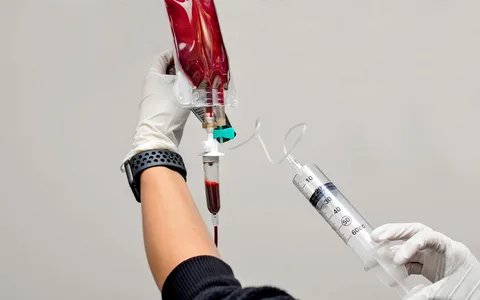 Blood infusion procedure