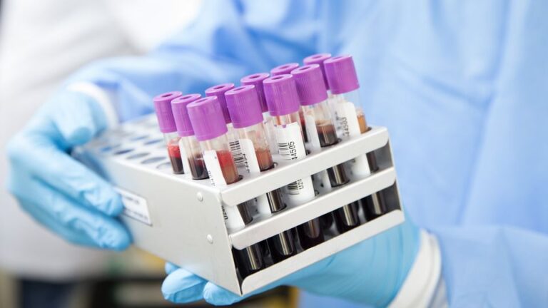 Advanced Functional Lab Testing Delray Beach