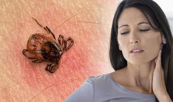 Lyme Disease Treatment Delray Beach